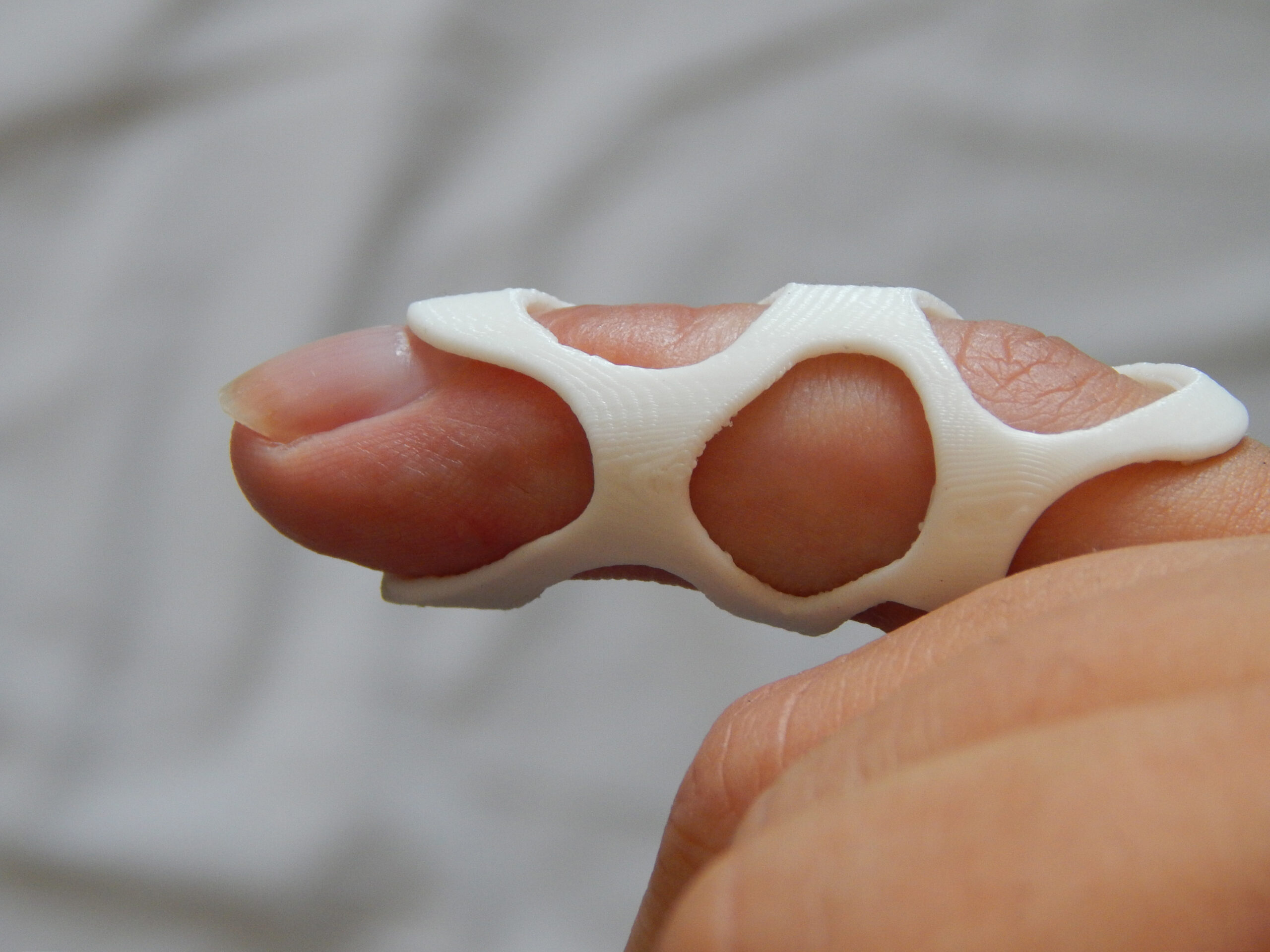 Eine Nahaufnahme eines Fingers mit einer 3D-gedruckten weißen Fingerschiene mit sechseckigem Muster. Das innovative Design wurde möglicherweise von der Hochschule Coburg inspiriert. Der Hintergrund ist ein weichgezeichneter grauer Stoff.